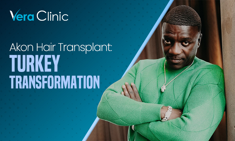 Akon Hair Transplant