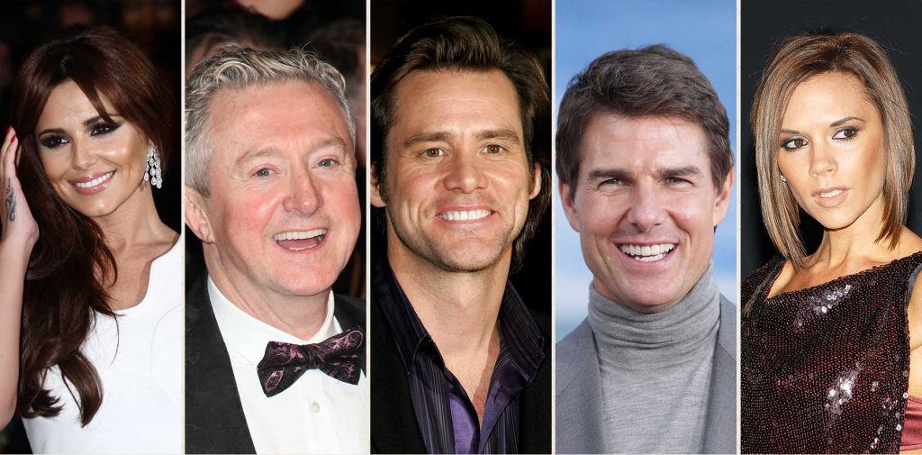 Celebrities with Dental Implants