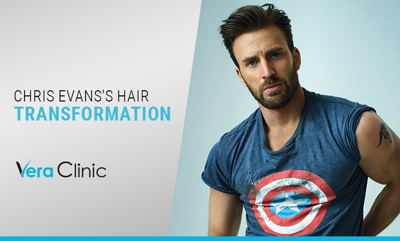 Chris Evans's Hair Transformation
