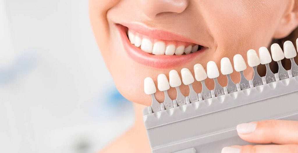 Dentisterie Esthétique