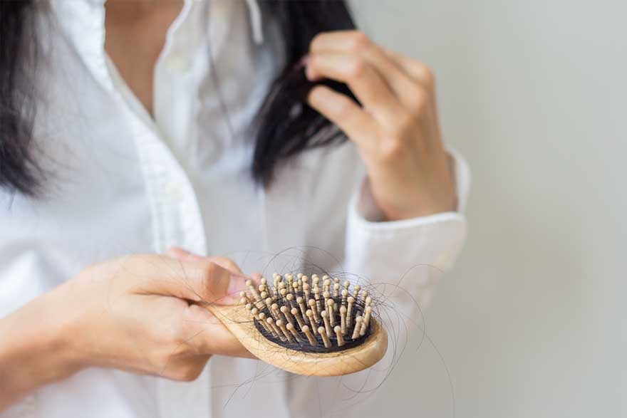 Female Alopecia