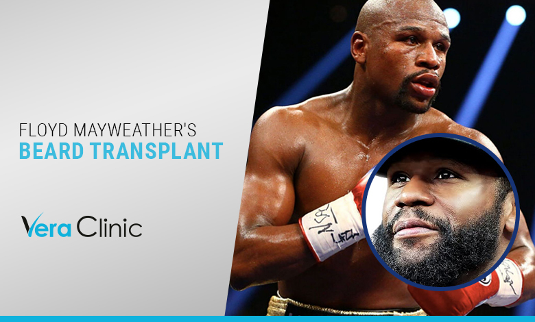 Floyd Mayweather's Beard Transplant