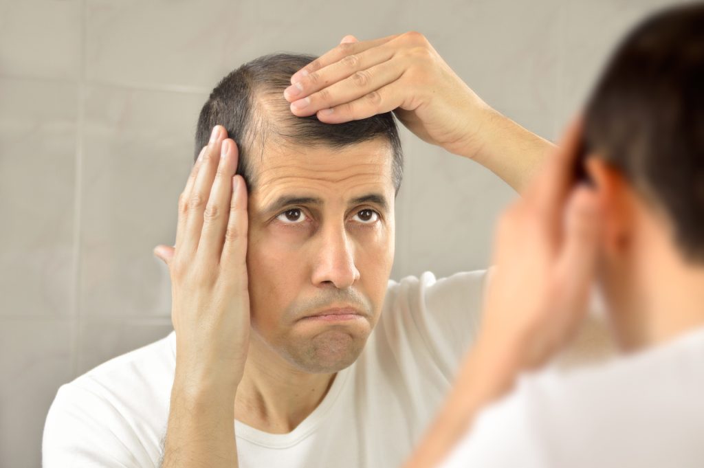 man controls hair loss and unhappy gazing at you in the mirror