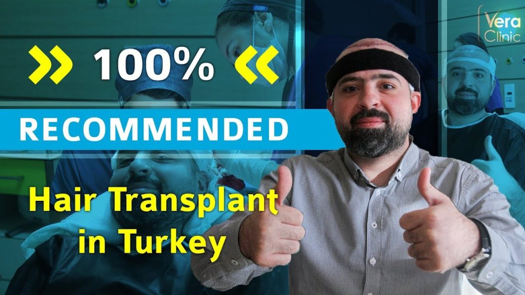 Sharif Hair transplant Experience