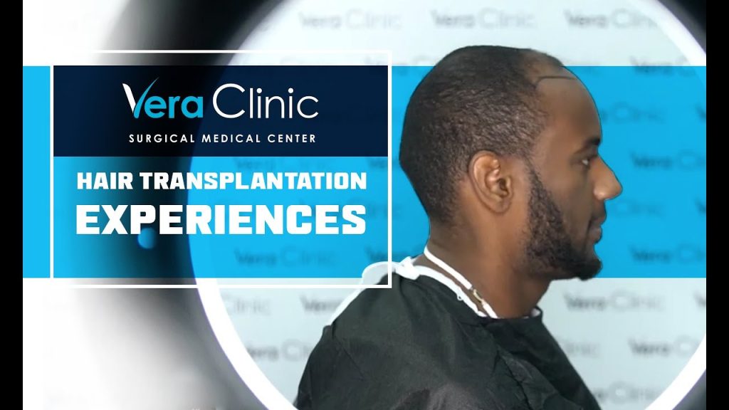 Hair Transplant Services