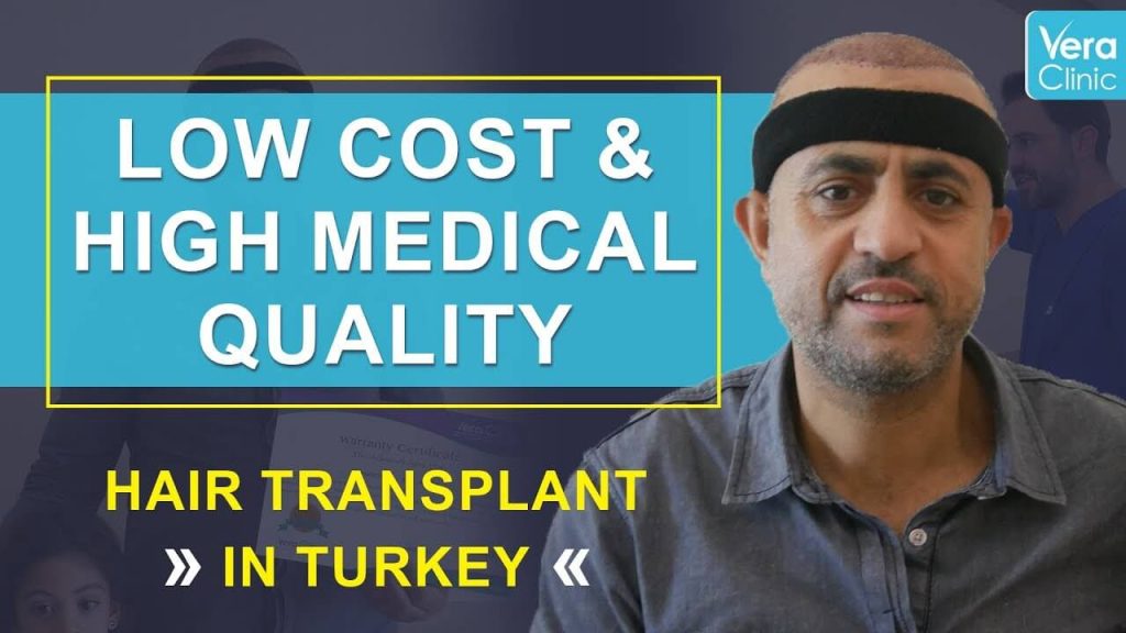 London hair Transplant experience