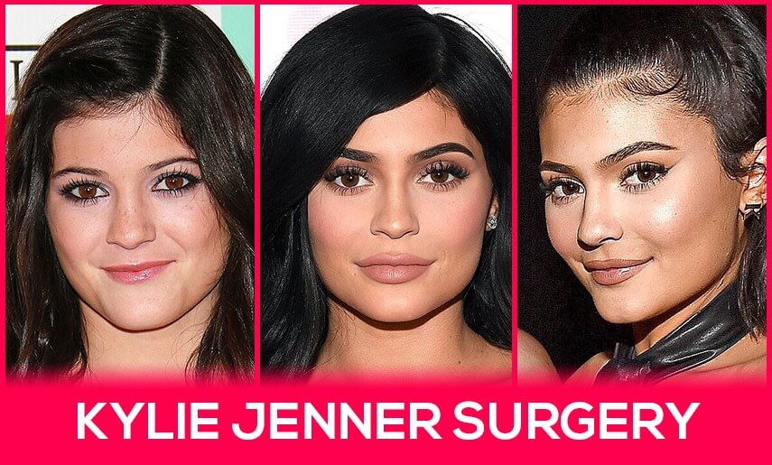 Kylie Jenner Surgery