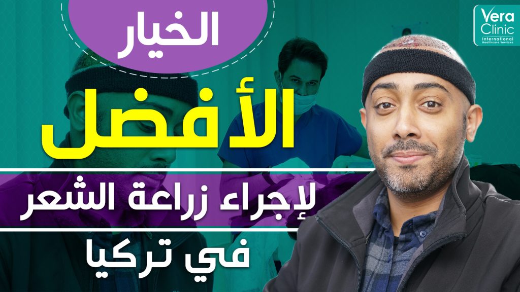 experience of hair transplantation in Turkey