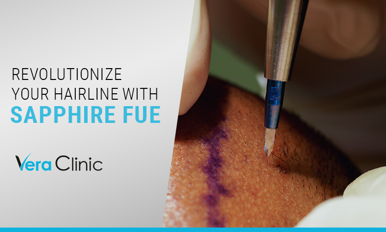 Revolutionary FUE Hair Transplant