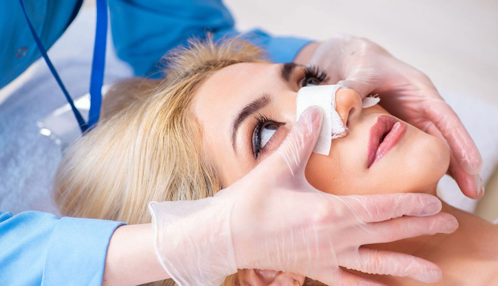 Rhinoplasty Recovery