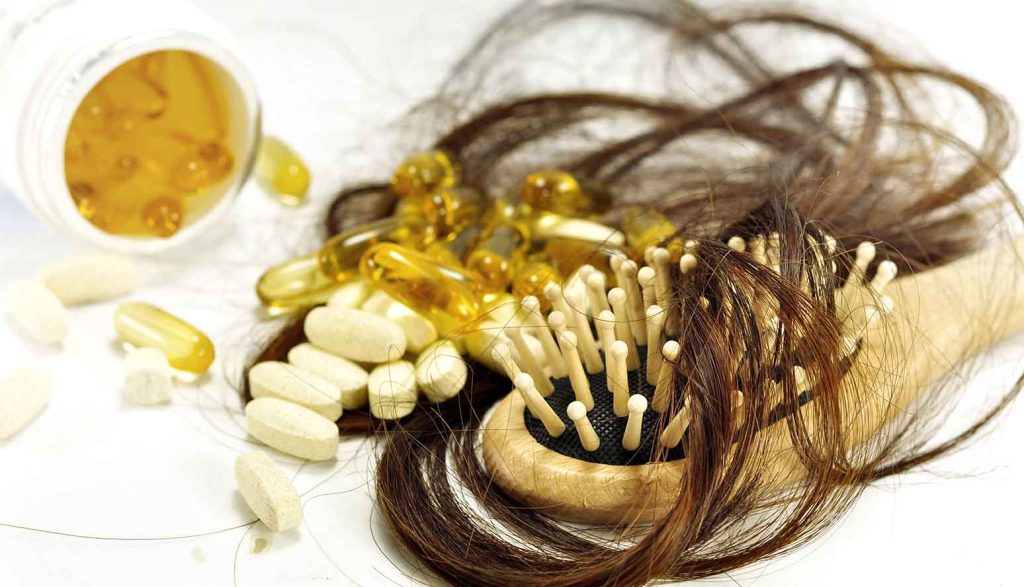 Science Of Androgenic Alopecia