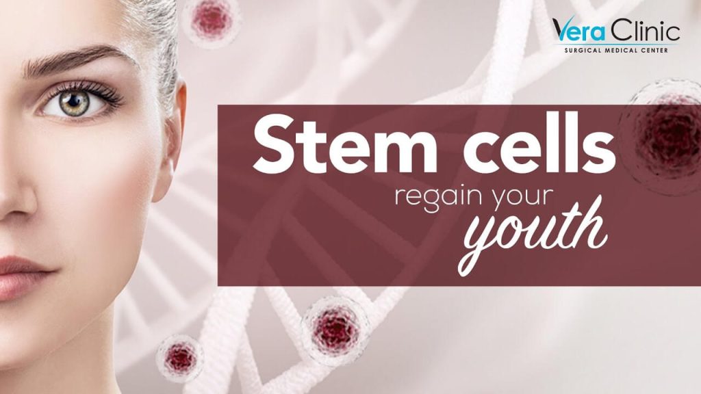 Stem Cell Therapy