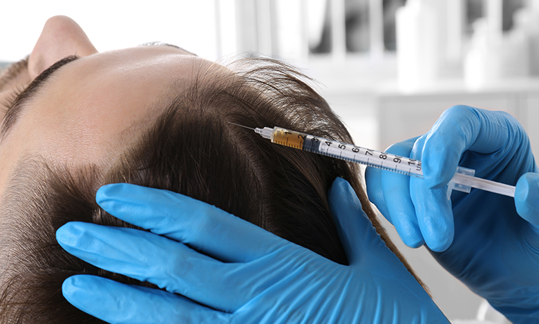 Best hair loss treatments