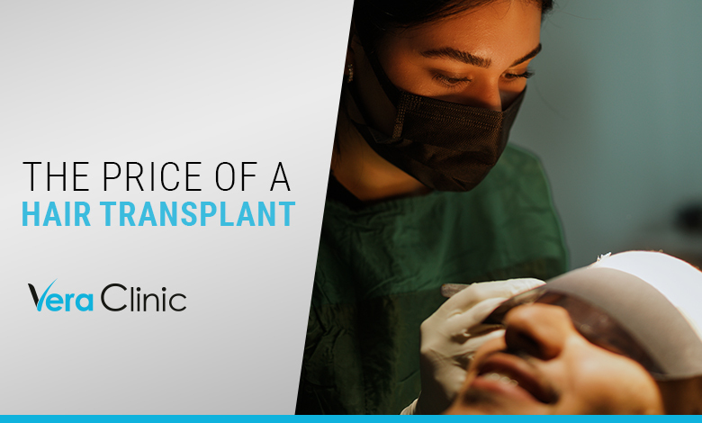The Price of a Hair Transplant