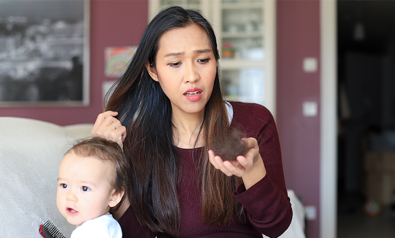 Postpartum hair loss