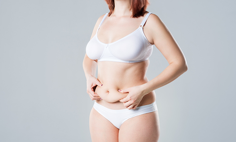 tummy tuck