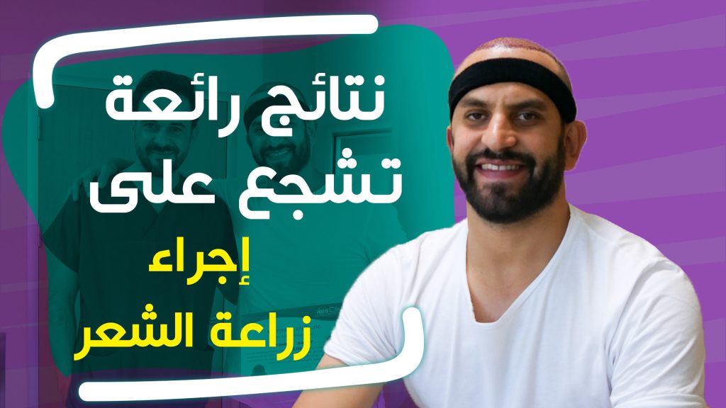Results of hair transplantation in Turkey