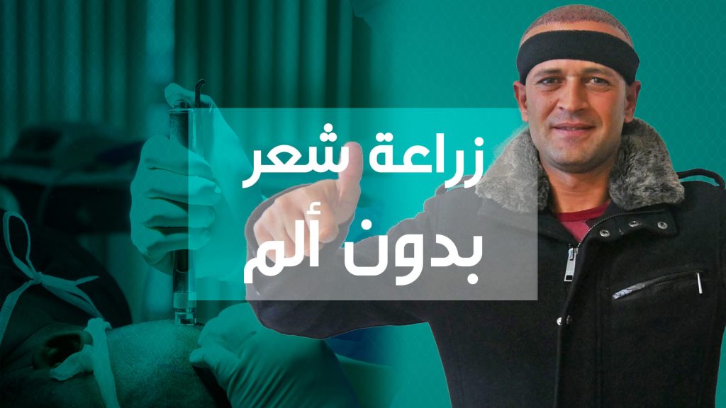 Results of hair transplantation in Turkey