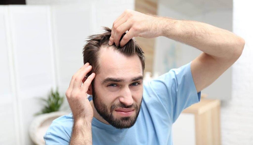 Chute de cheveux Psoriasis In Hair
