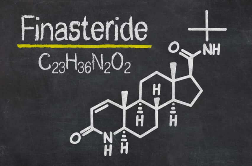 finasteride