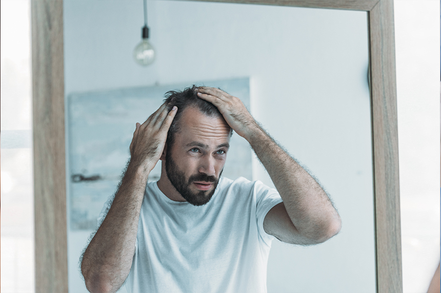 how to prevent hair loss