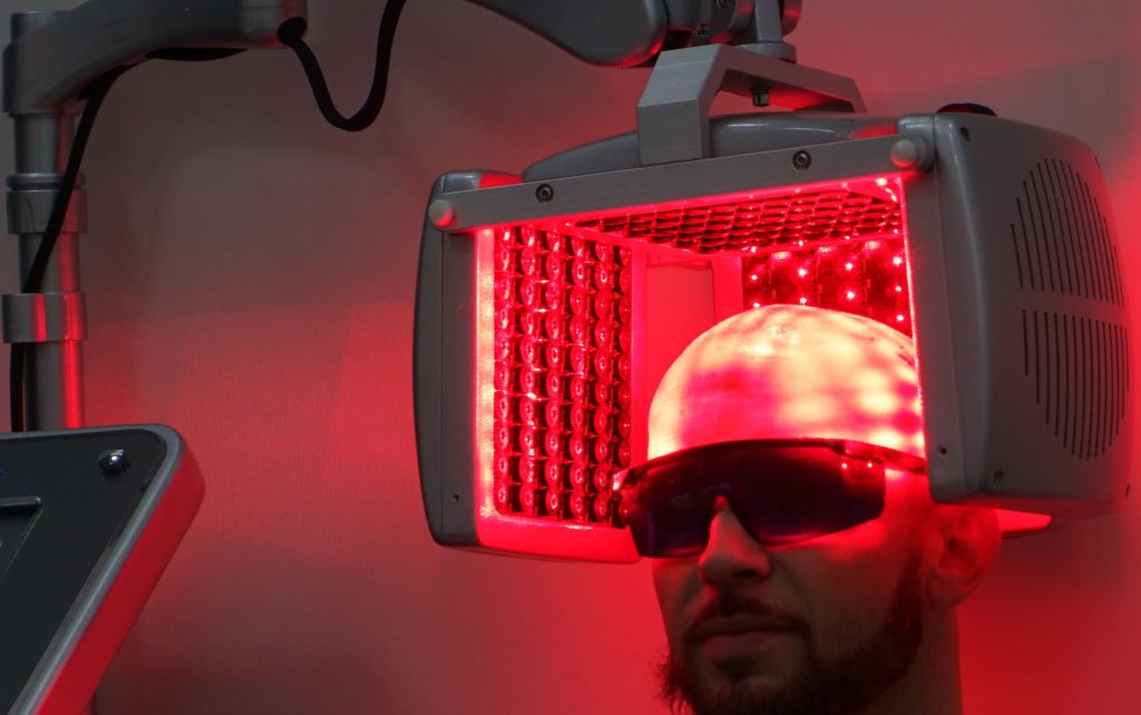 laser therapy hair growth