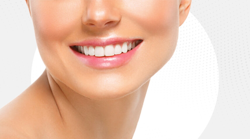 What is Composite Bonding