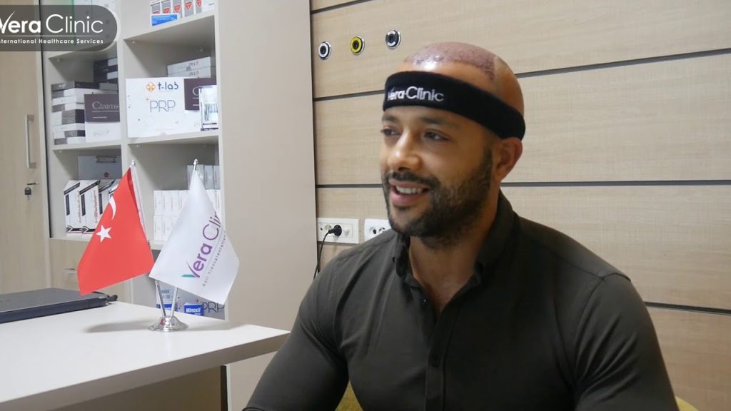 hair transplant case study