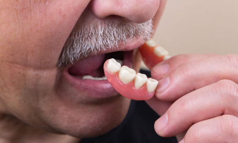 man with missing teeth