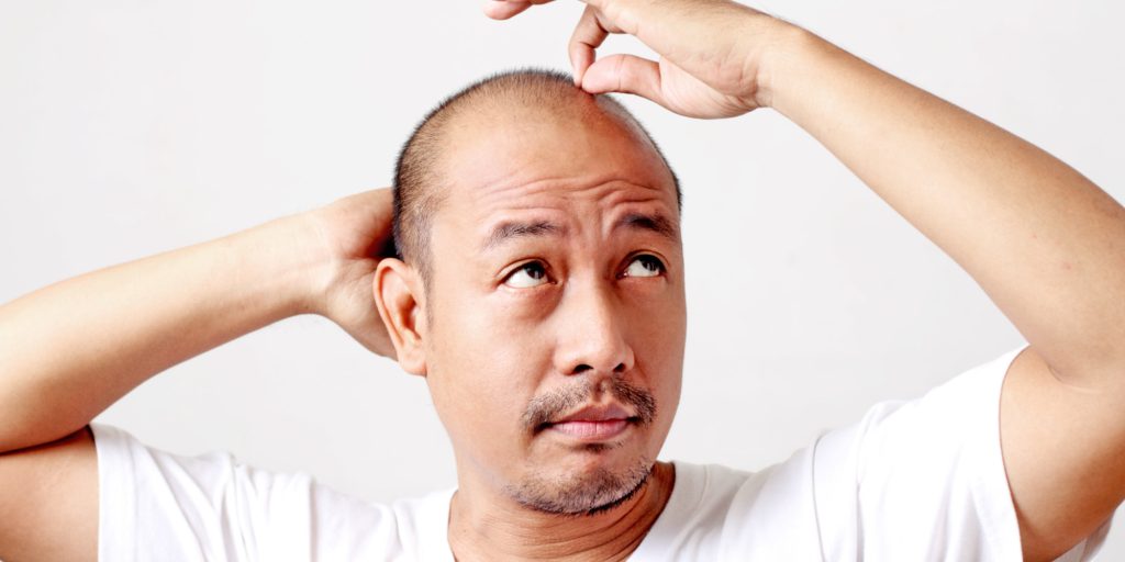man looking for hair transplant