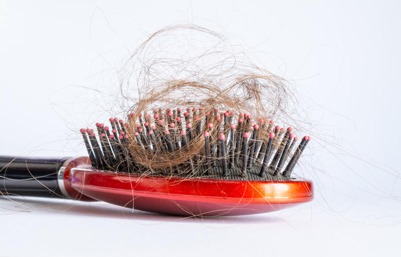 Alopecia Androgénica