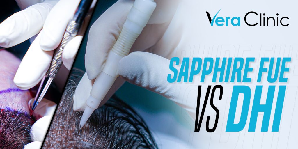 Sapphire Fue vs DHI