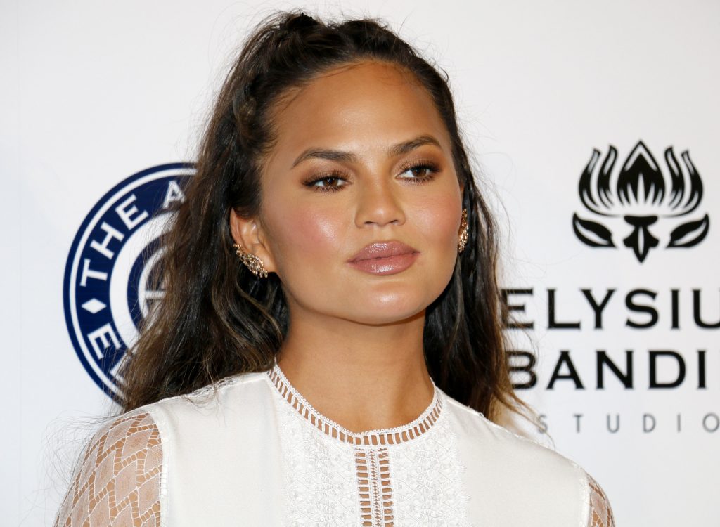 Chrissy Teigen's Transplanted Eyebrows