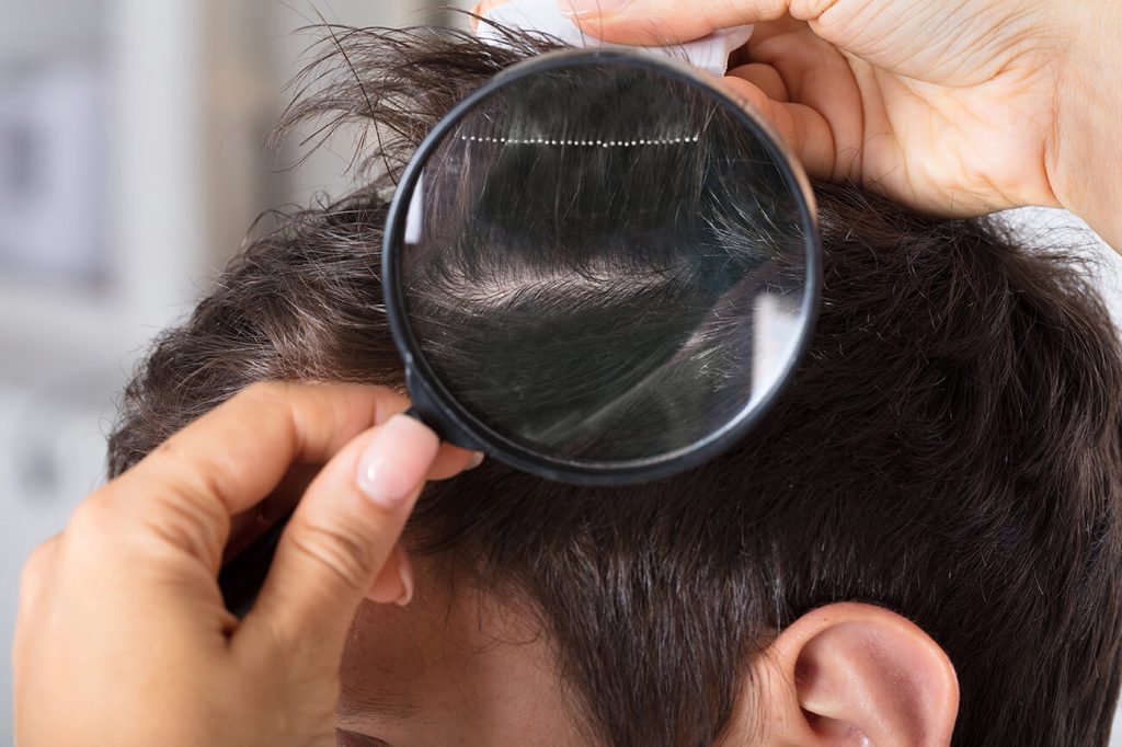 close up magnifying glass of scalp and hair