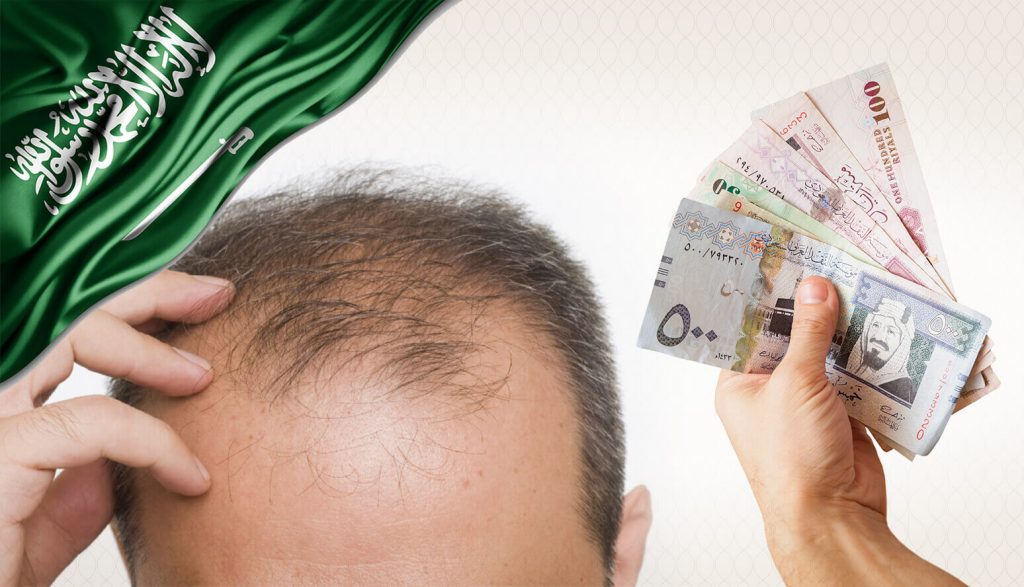 ما هي تكلفة الزراعة في السعودية